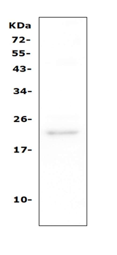 Anti-TAPA1/CD81 Antibody Picoband® Boster Bio