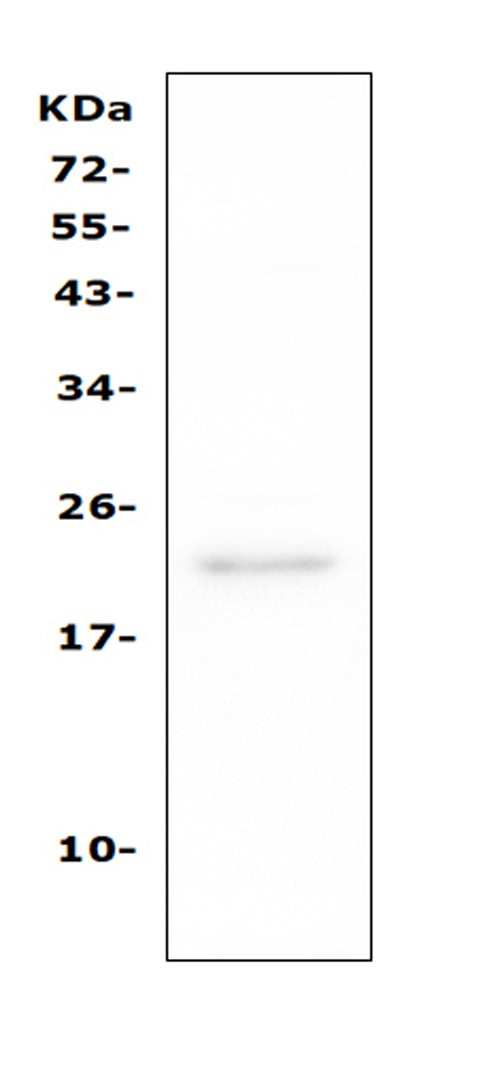 Anti-TAPA1/CD81 Antibody Picoband® Boster Bio