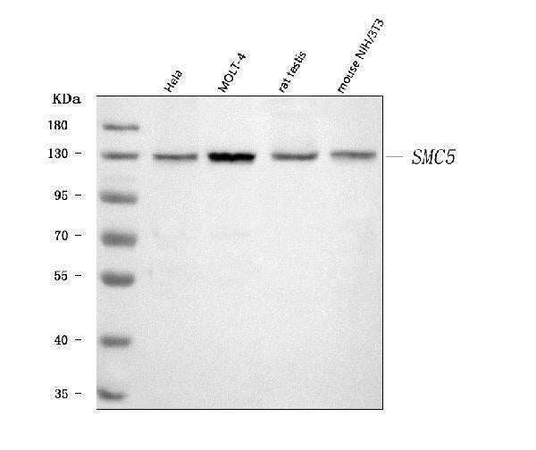 Anti-SMC5 Antibody Picoband® Boster Bio