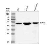 Anti-Cannabinoid receptor 1/CNR1 Antibody Picoband® Boster Bio
