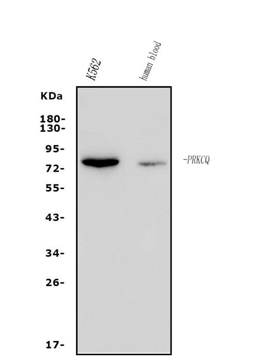 Anti-PKC theta/PRKCQ Antibody Picoband® Boster Bio
