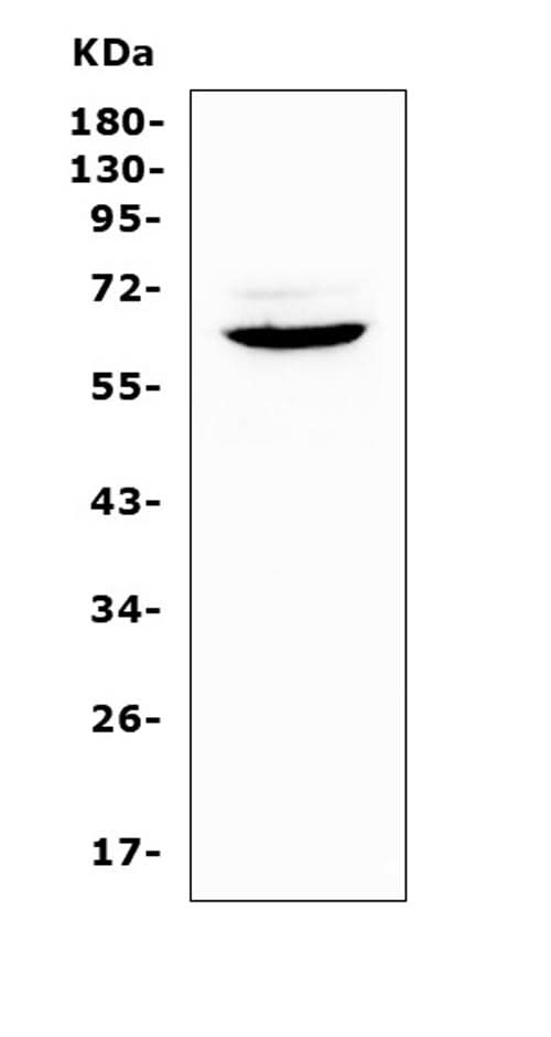 Anti-Heparanase 1/Hpse Antibody Picoband® Boster Bio