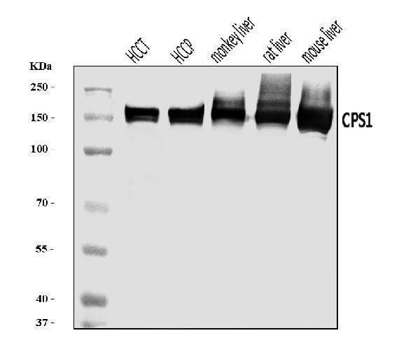 Anti-CPS1 Antibody Picoband® Boster Bio