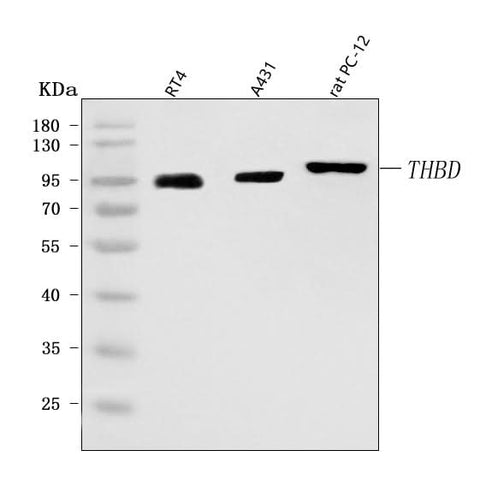 Anti-Thrombomodulin/THBD Antibody Picoband® Boster Bio