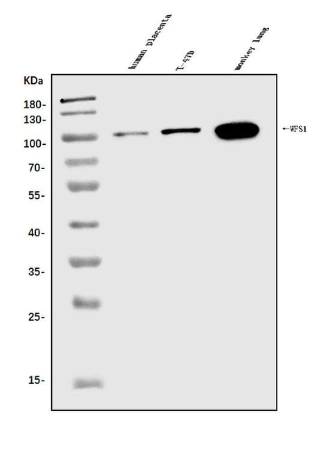 Anti-WFS1 Antibody Picoband® Boster Bio