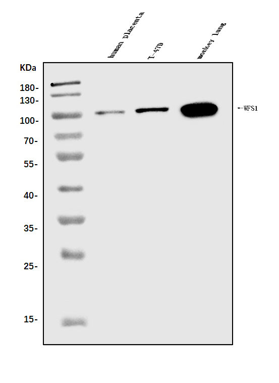 Anti-WFS1 Antibody Picoband® Boster Bio