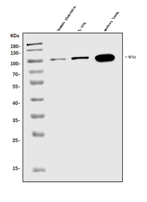 Anti-WFS1 Antibody Picoband® Boster Bio