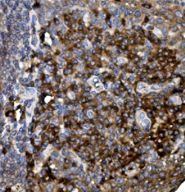 Anti-CD74 Antibody Boster Bio