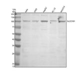 Anti-SLCO1B1 Antibody Picoband® Boster Bio