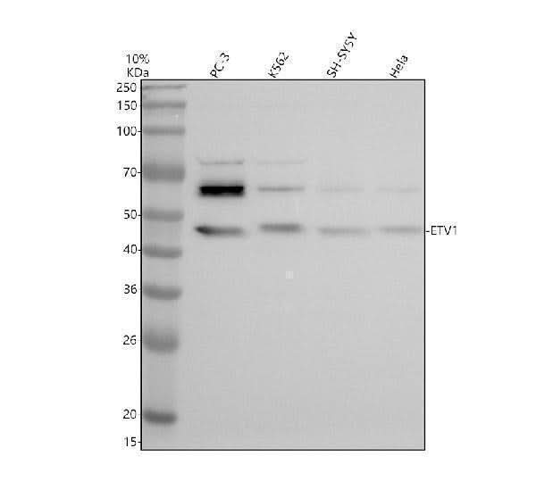 Anti-DHRS2 Antibody Picoband® Boster Bio