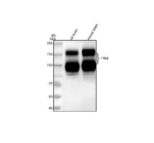Anti-TrkB/NTRK2 Antibody Picoband® Boster Bio