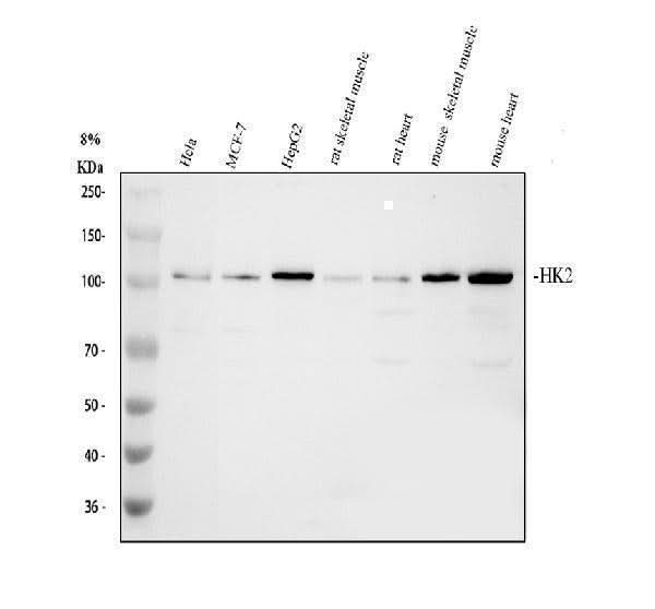 Anti-Hexokinase II/HK2 Antibody Picoband® Boster Bio
