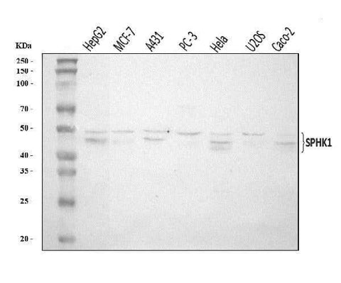 Anti-SPHK1 Antibody Picoband® Boster Bio
