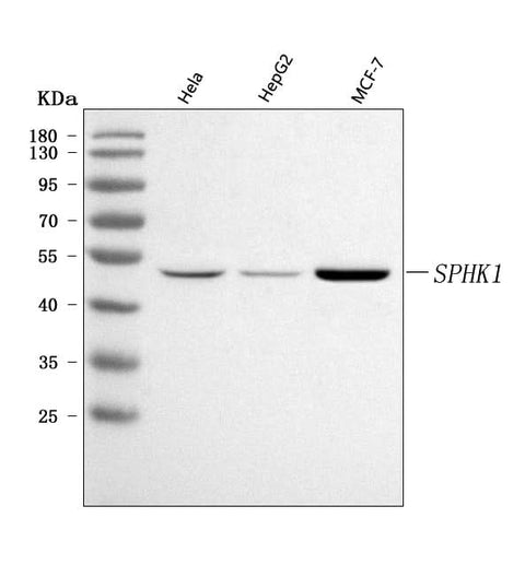 Anti-SPHK1 Antibody Picoband® Boster Bio
