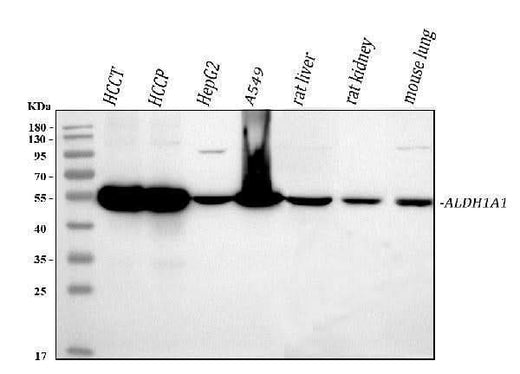 Anti-Retinal dehydrogenase 1 ALDH1A1 Antibody Picoband® Boster Bio