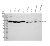 Anti-Tip60/KAT5 Antibody Picoband® Boster Bio