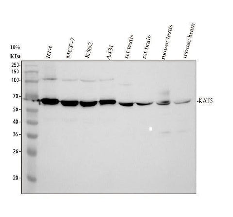Anti-Tip60/KAT5 Antibody Picoband® Boster Bio