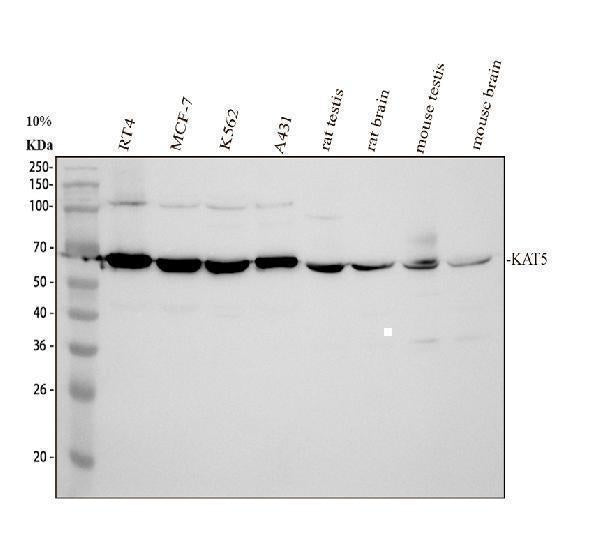 Anti-Tip60/KAT5 Antibody Picoband® Boster Bio