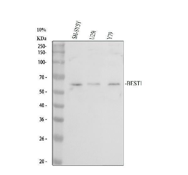 Anti-Bestrophin/BEST1 Antibody Picoband® Boster Bio