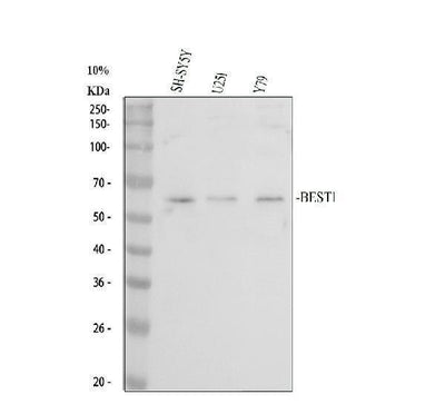 Anti-Bestrophin/BEST1 Antibody Picoband® Boster Bio
