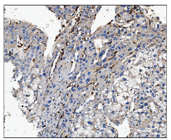 Anti-CD16/FCGR3A Antibody Boster Bio