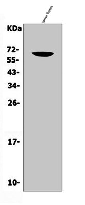 Anti-CD16/Fcgr3 Antibody Picoband® Boster Bio