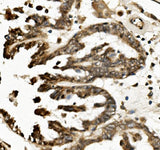 Anti-TXNIP Antibody Picoband® Boster Bio