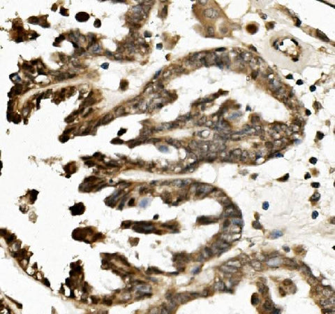 Anti-TXNIP Antibody Picoband® Boster Bio