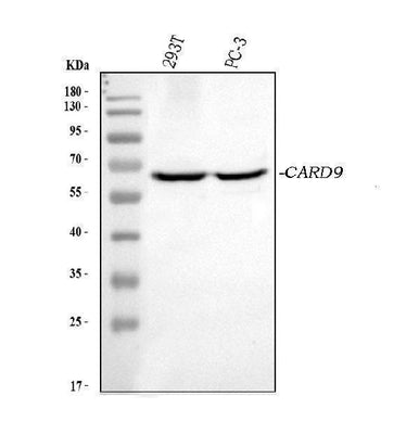 Anti-CARD9 Picoband® Antibody Boster Bio