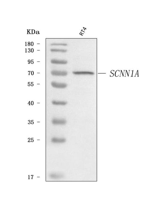 Anti-epithelial Sodium Channel alpha/SCNN1A Antibody Picoband® Boster Bio