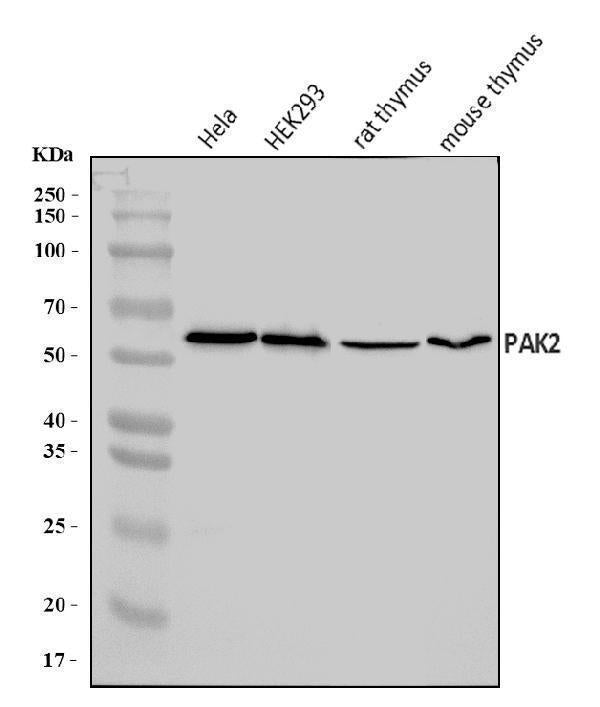 Anti-PAK2 Antibody Picoband® Boster Bio
