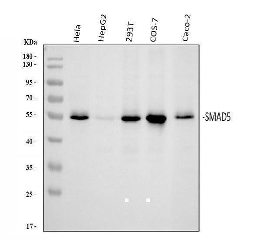 Anti-SMAD5 Antibody Picoband® Boster Bio
