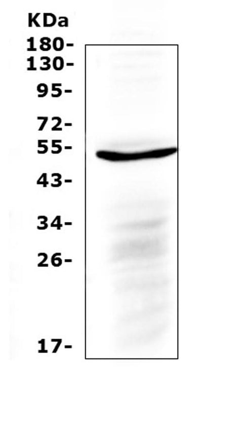 Anti-IL6R Antibody Picoband® Boster Bio