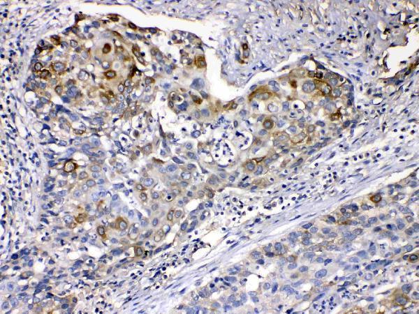 Anti-Cytokeratin 14/KRT14 Antibody Picoband® Boster Bio