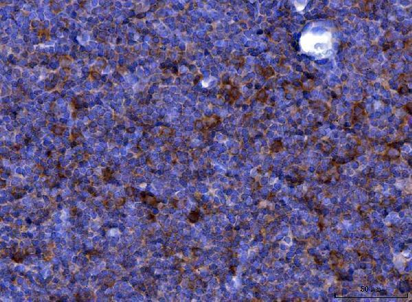 Anti-Eotaxin/Ccl11 Antibody Boster Bio