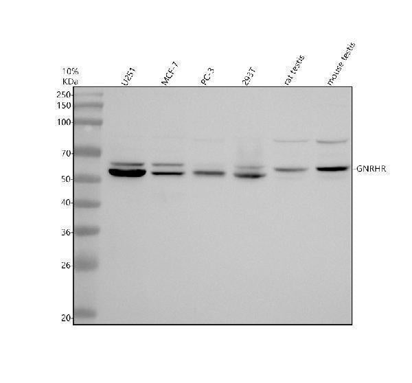 Anti-GNRHR Antibody Picoband® Boster Bio
