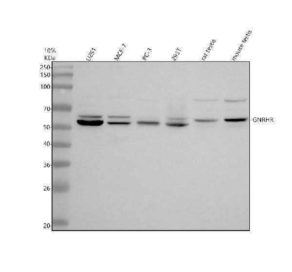 Anti-GNRHR Antibody Picoband® Boster Bio