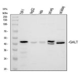 Anti-GALT Antibody Picoband® Boster Bio