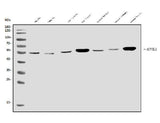 Anti-ALK-1/ACVRL1 Antibody Picoband® Boster Bio