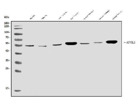 Anti-ALK-1/ACVRL1 Antibody Picoband® Boster Bio