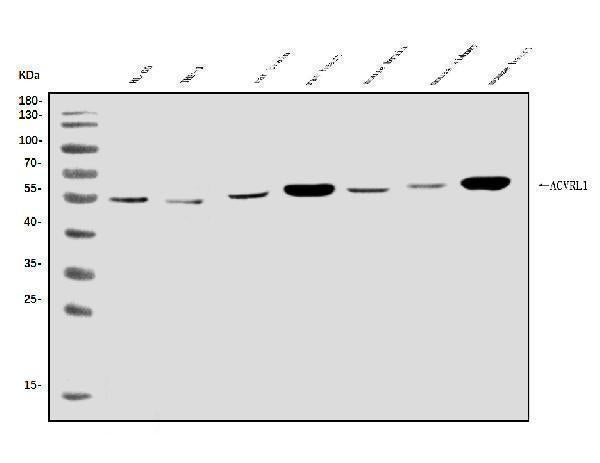 Anti-ALK-1/ACVRL1 Antibody Picoband® Boster Bio
