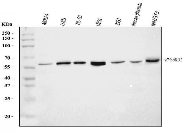 Anti-S6K1/RPS6KB1 Antibody Picoband® Boster Bio