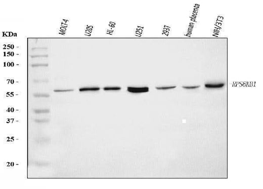 Anti-S6K1/RPS6KB1 Antibody Picoband® Boster Bio