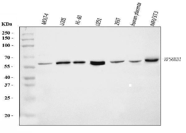 Anti-S6K1/RPS6KB1 Antibody Picoband® Boster Bio