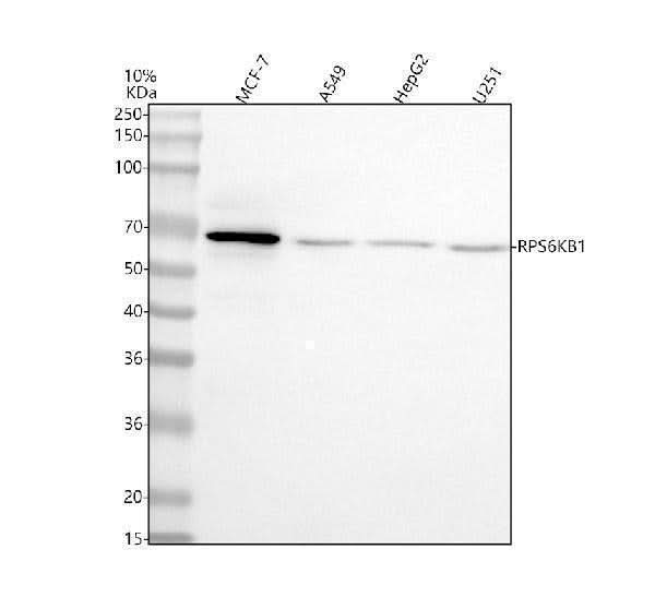 Anti-p70 S6K/RPS6KB1 Antibody Picoband® Boster Bio