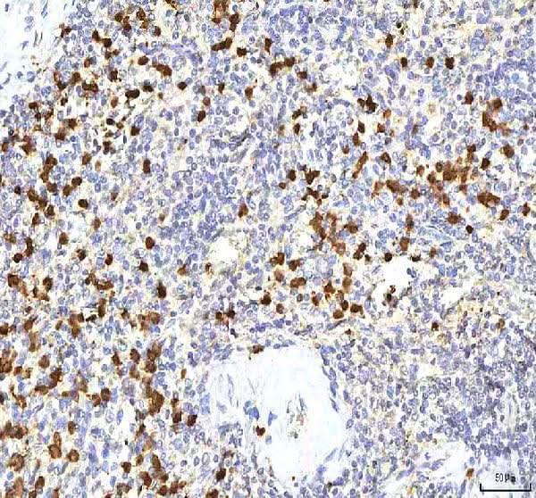 Anti-S100A12 Antibody Boster Bio