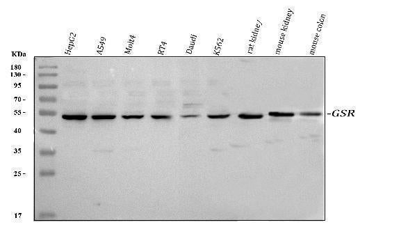 Anti-Glutathione Reductase/GSR Antibody Picoband® Boster Bio