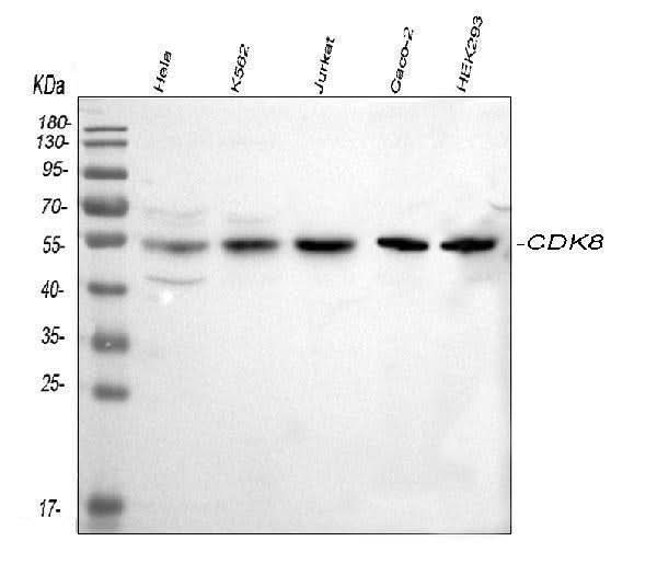 Anti-CDK8 Antibody Picoband® Boster Bio