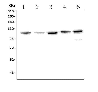 Anti-Eph receptor B2/EPHB2 Antibody Picoband® Boster Bio