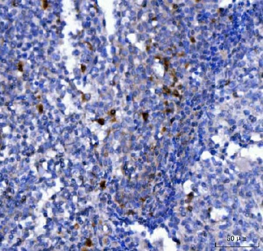 Anti-NCR1 Antibody Boster Bio